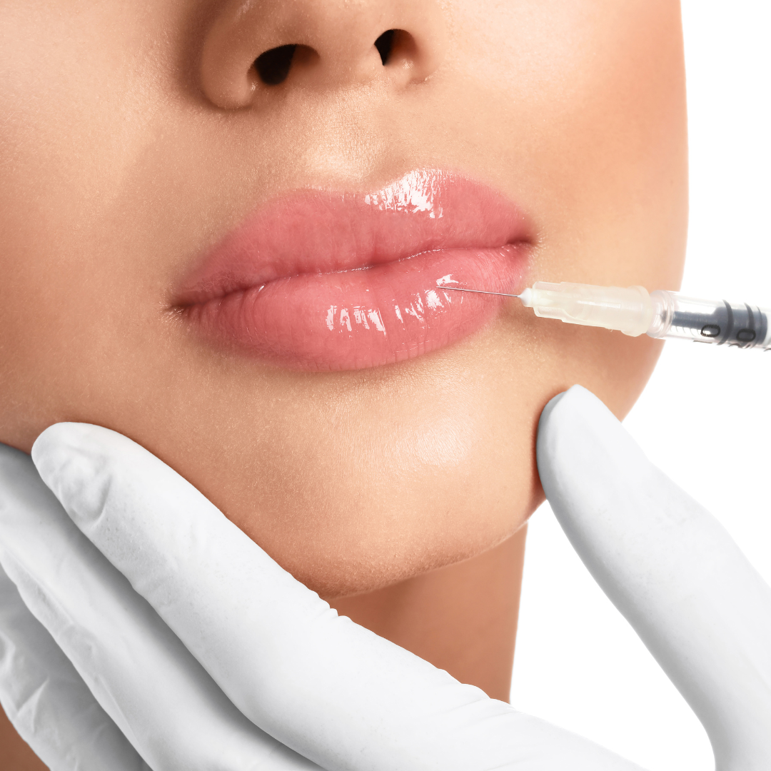 Hyaluronic Acid Fillers