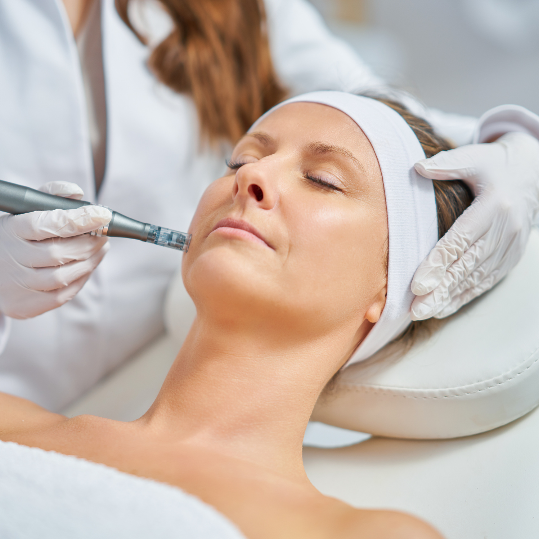 Microneedling