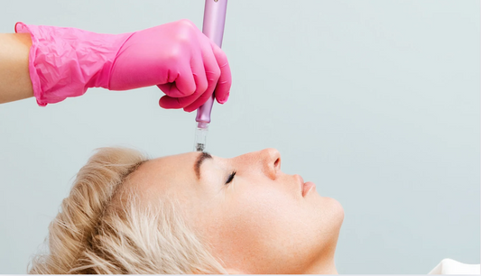 the role of microneedling in modern skincare