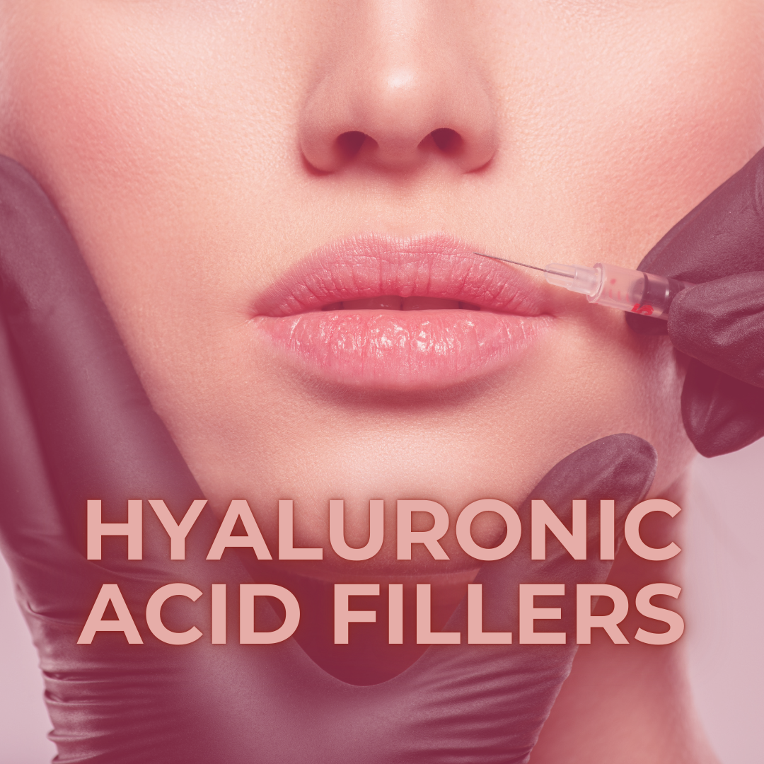 Hyaluronic Acid Fillers