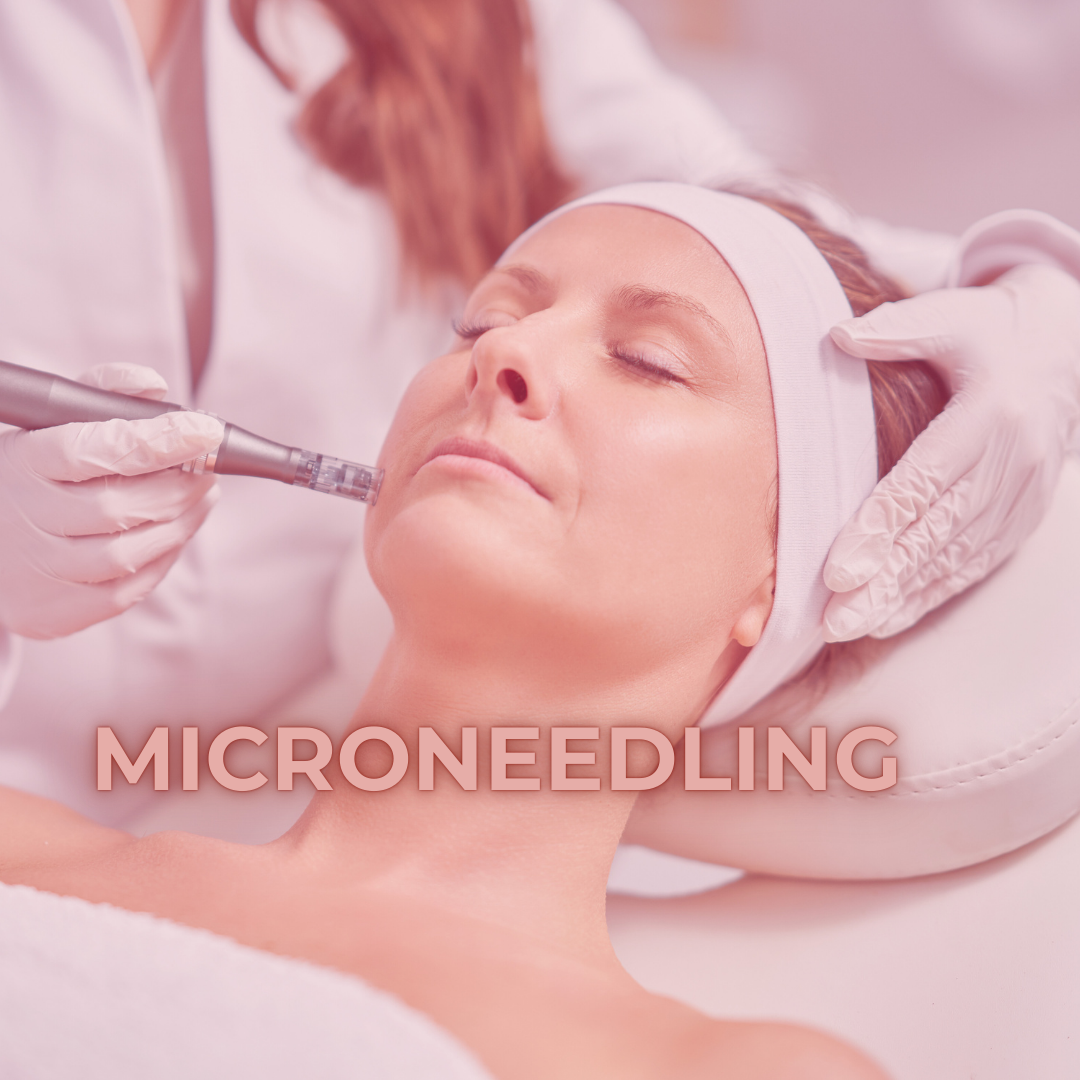 Microneedling