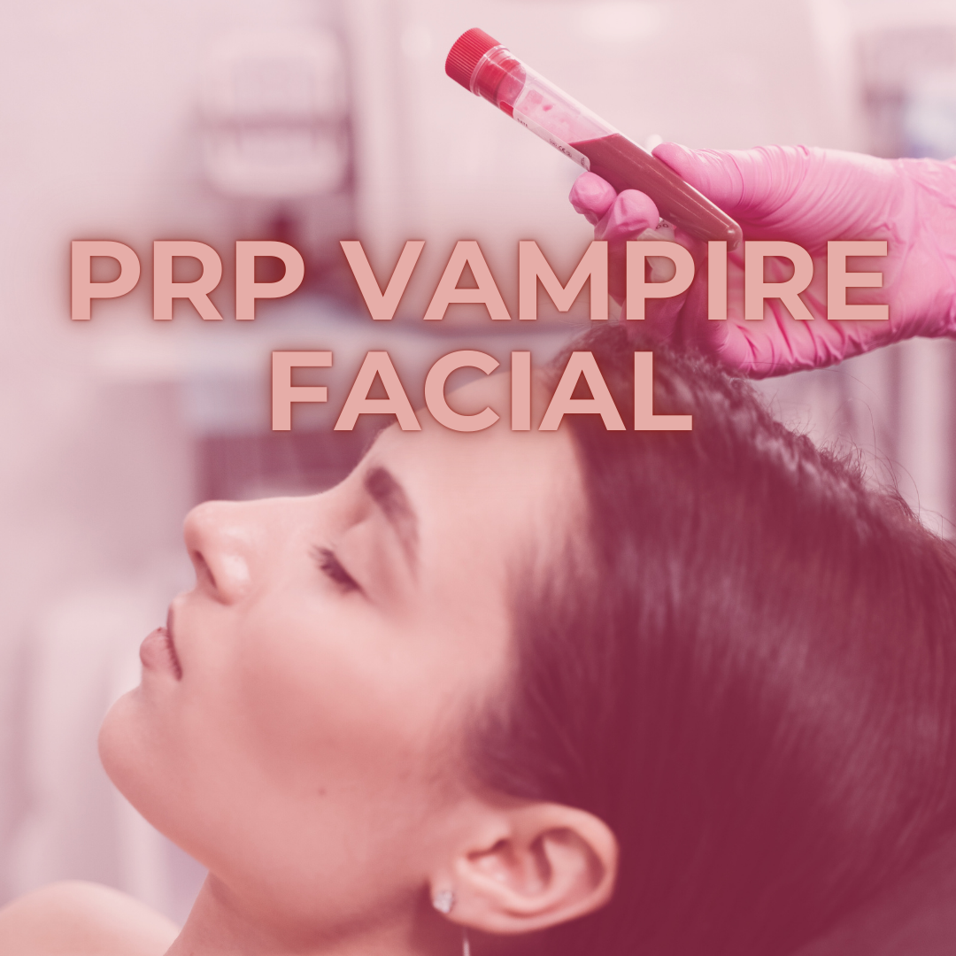 PRP Vampire Facial